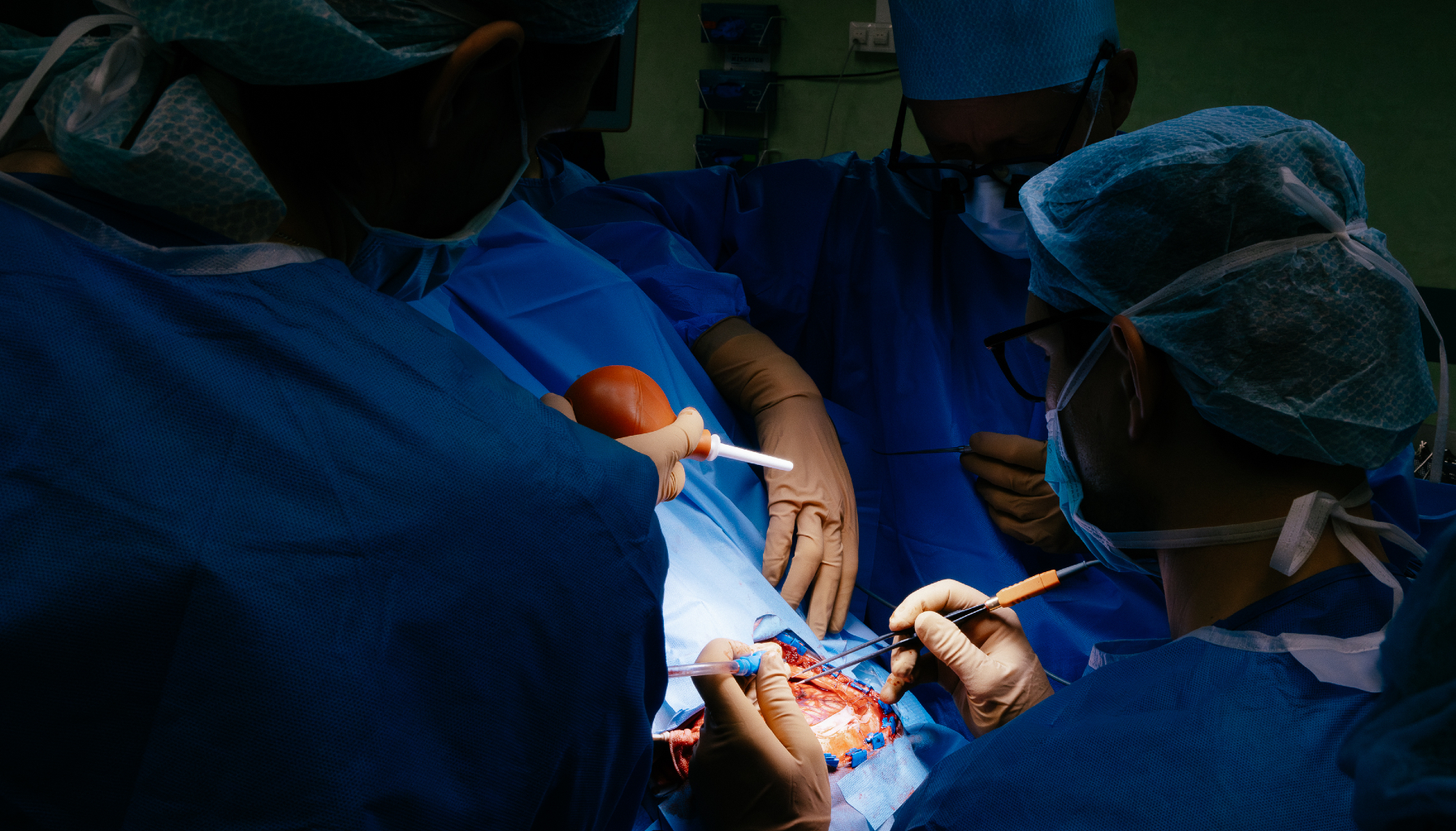 Troje medyk&oacute;w w ubraniu operacyjnym, w ciemnym pomieszczeniu stoi nad otwartą czaszką z widocznym m&oacute;zgiem. Niekt&oacute;rzy trzymają narzędzia.